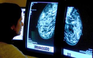 The future outlook for cancer survival rates does not look good if the current trajectory is continued upon (PA)