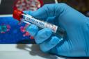 Prospect of second coronavirus spike monitored ‘very closely’