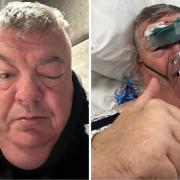 Martin after Pride of St Helens and right, a day later following his six-hour surgery